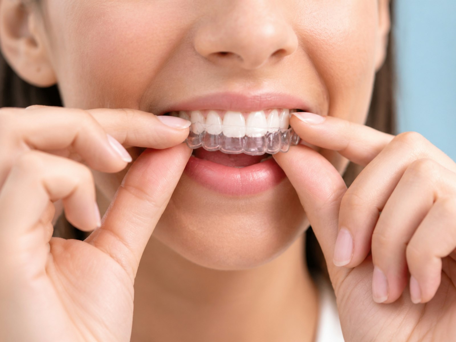 Clear Aligners in Manchester in 2026: An Honest Look at What's on Offer