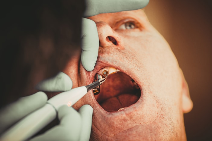 Cracked a Tooth? A Crown Almost Always Sorts It
