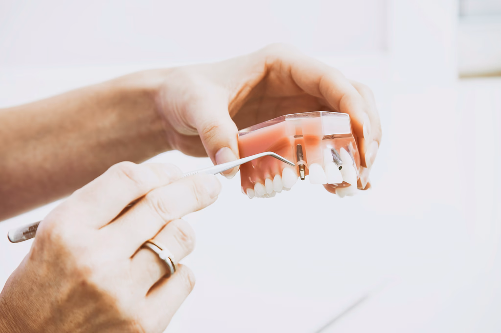 Dental Implant Failure Rates UK
