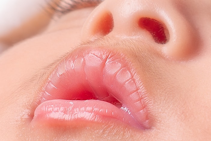 Dry Socket After Tooth Extraction: What It Is, How It Feels, and What Fixes It