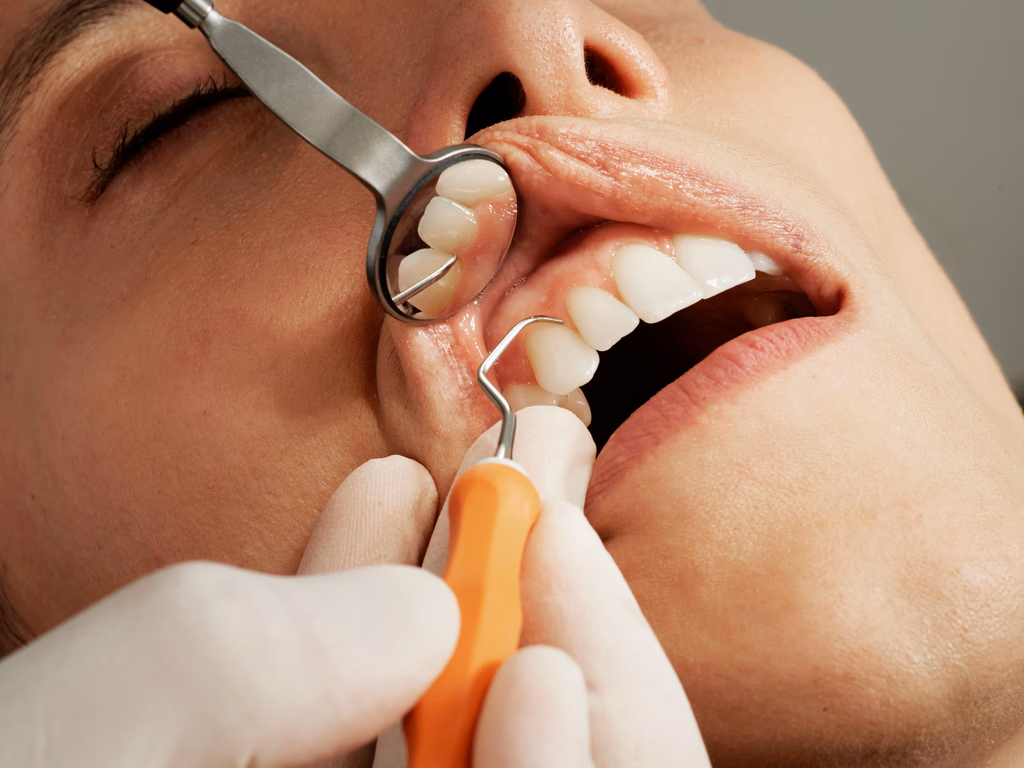 Gum Disease Treatment Prices