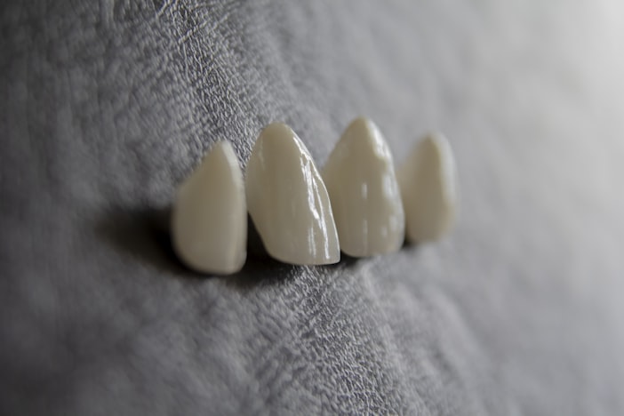 Professional vs Home Teeth Whitening: Cost, Results, and What Actually Works