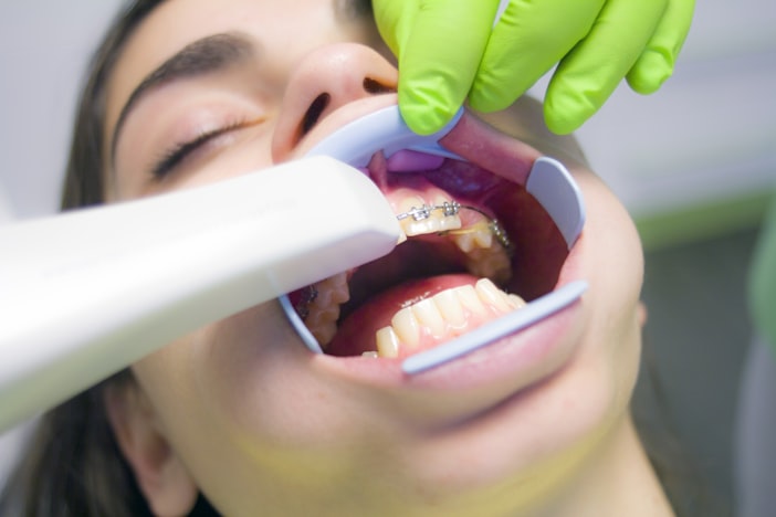 Root Canal on a Front Tooth: Cost, Procedure, and Why It's the Quick One
