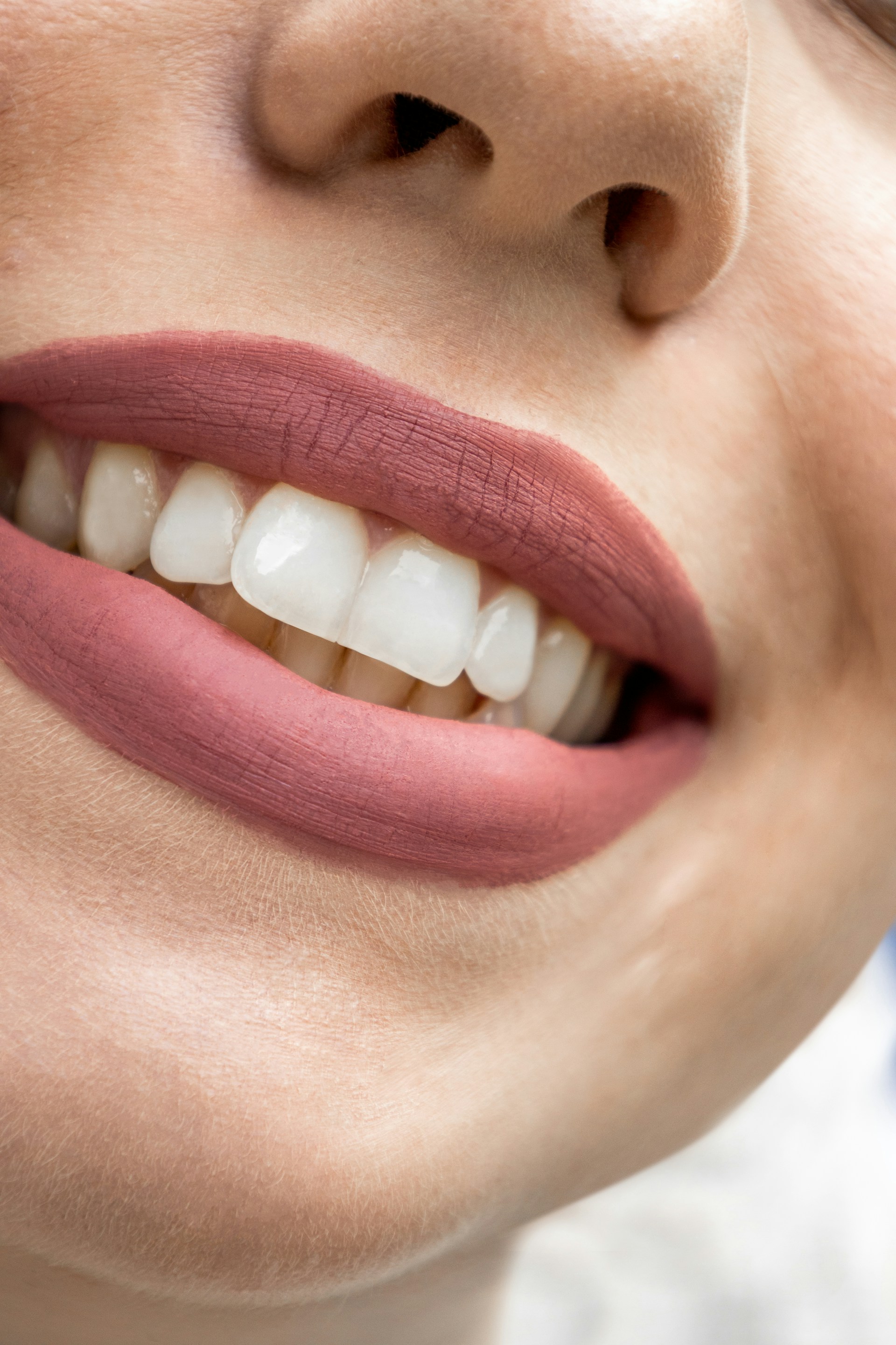 Teeth Whitening Cost UK: What You'll Actually Pay in 2026