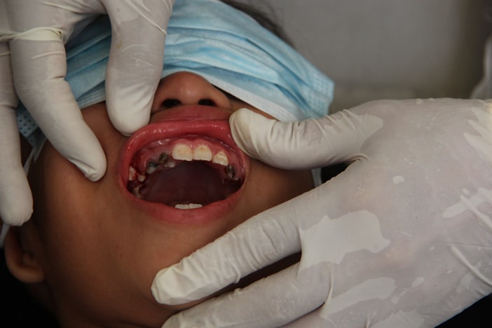 Tooth Infection Spreading to Body: Warning Signs and When to Go to A&E